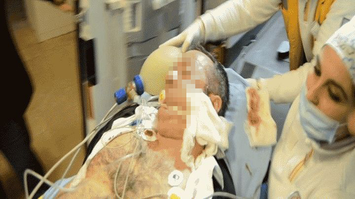 'Yüzünde kurşun giriş yeri var!'