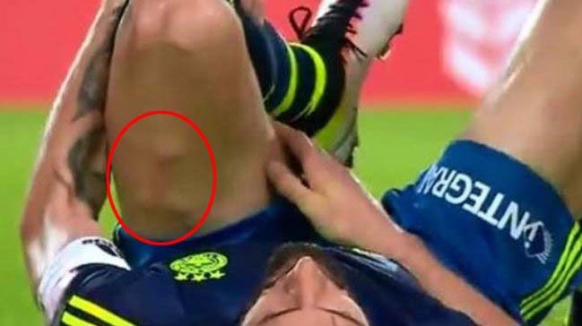 Mehmet Topal'ın şoke eden görüntüsü!