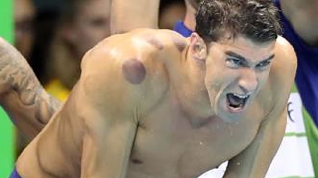 Michael Phelps'teki izlerin sırrı belli oldu!