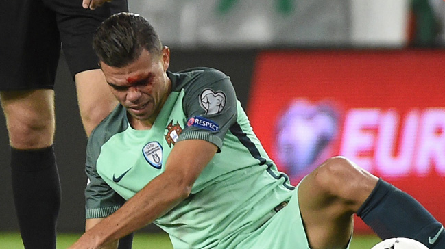 Korkutan görüntü! Pepe kanlar içinde...