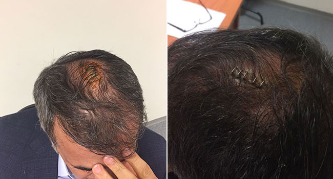 Şenol Güneş'in başına 5 dikiş atıldı