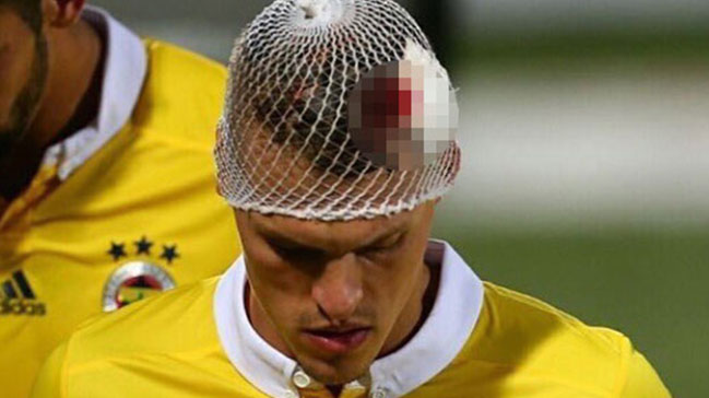 Skrtel'in kafası kanlar içinde